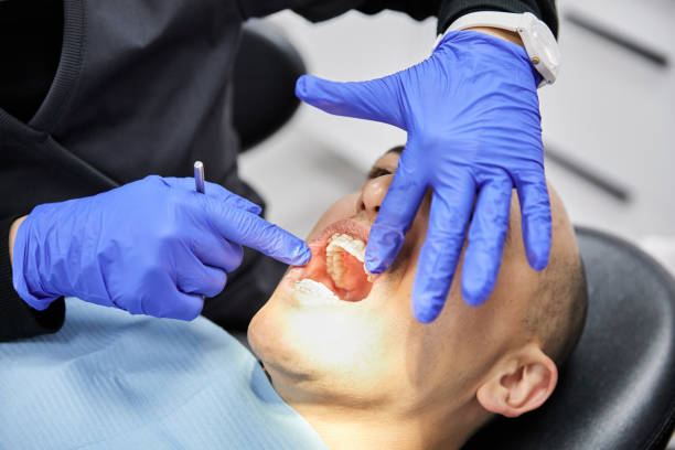 Best Emergency Wisdom Teeth Removal in Detroit, MI