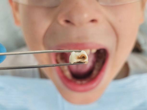 Best Emergency Treatment for Toothache in Detroit, MI